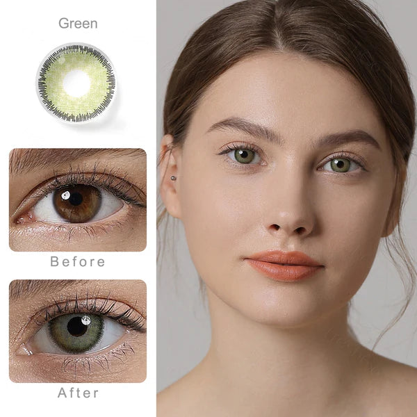 Shine Green